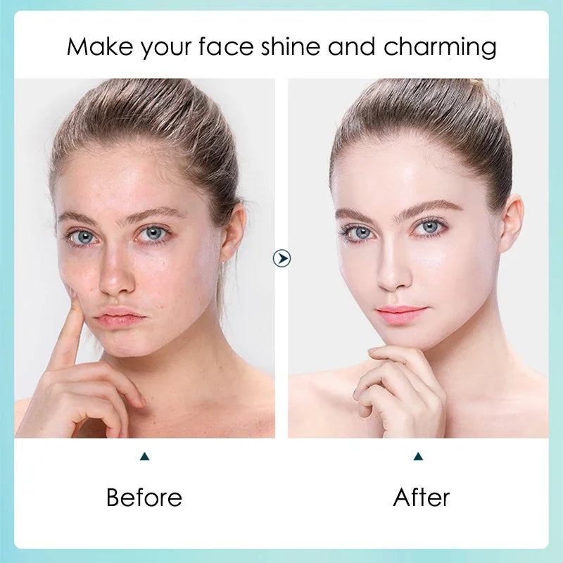hyaluronic acid facial masks